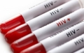 SIDA avanseaza ascunsa in Europa de Est, in umbra covid-19