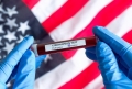 Congresul american a aprobat alocarea a 8,3 miliarde de dolari pentru lupta împotriva coronavirus