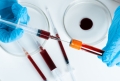 Sanofi oferă un nou tratament inovator împotriva hemofiliei