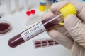 Israelul a depistat o varianta neidentificata a coronavirusului